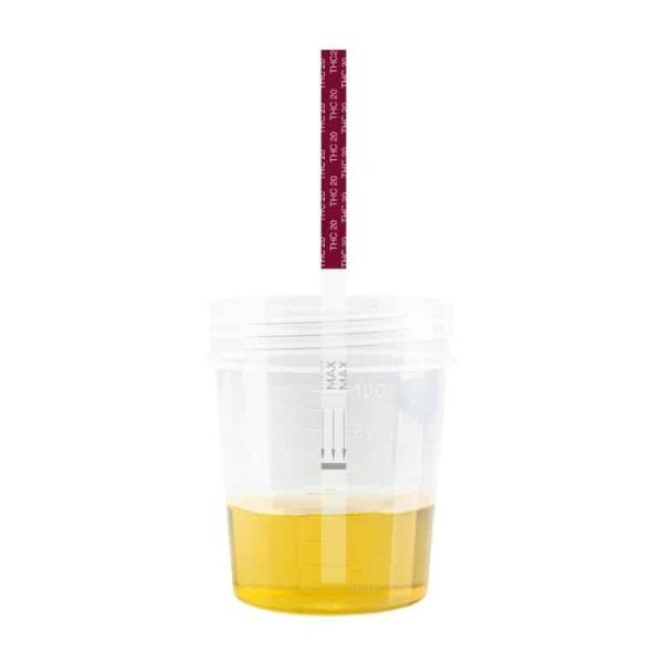 THC 20 test in urine sample